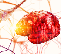 <em>Decision-IQ</em>: Integrating Novel Therapies Into Clinical Decision Making in Tardive Dyskinesia