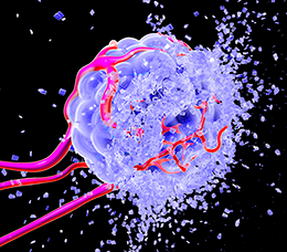 Tumor Lysis Syndrome in a Rapidly Evolving Treatment Landscape