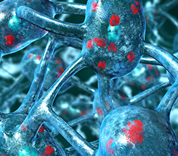 <em>Decision-IQ:</em> Managing Off Episodes in Parkinson’s Disease With Available and Emerging Therapies
