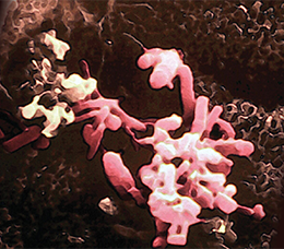 Optimizing the Management of Patients With IBS Today