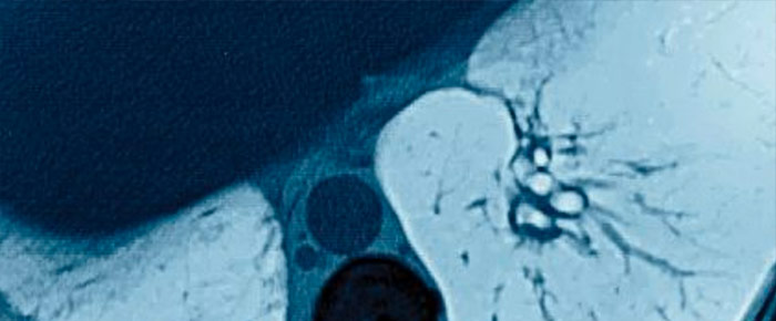 Pulmonology