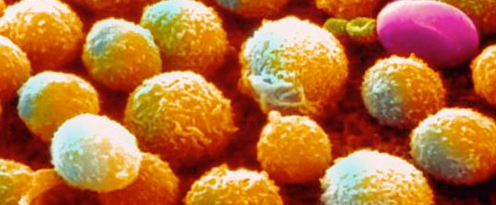 oncology